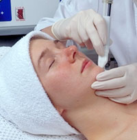 microdermabrasion